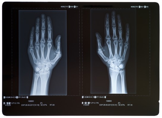 Coluna Fiscal: Uma radiografia da lei orçamentária