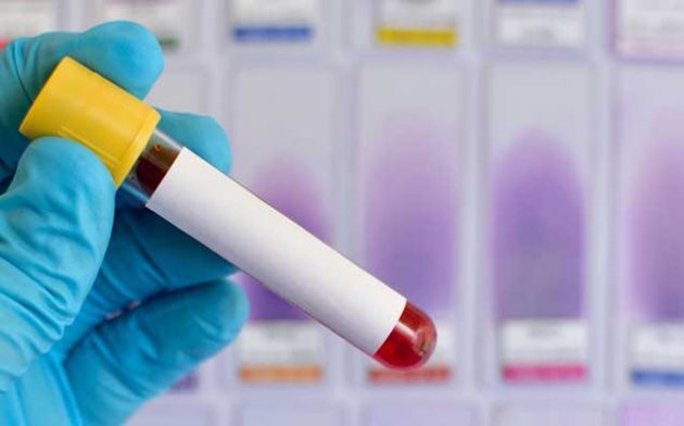 Coleta de sangue e análise do material colhido e ISS